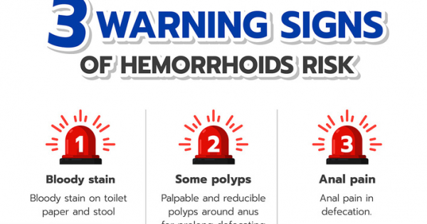 Hemorrhoid is a common condition originated from the collapse of the connective tissue of the rectal mucosa effecting to prolong large blood pool around this area. Low fiber meal is one of the important causes affecting to solid stool consistency and forc