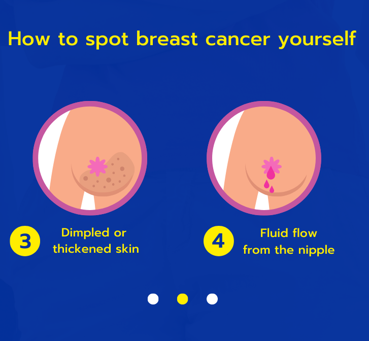 Breast Cancer Signs and Symptoms